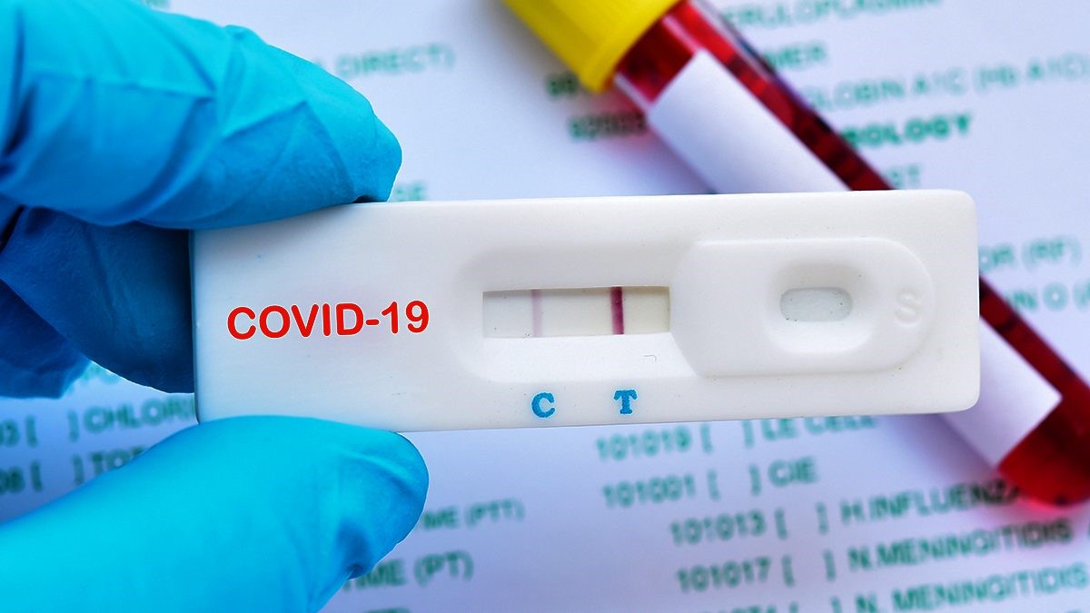 Πού θα γίνουν δωρεάν rapid tests το Σάββατο